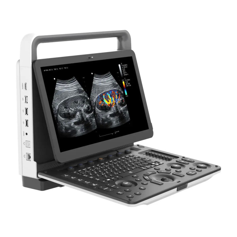 Ultrasonograf przenośny diagnostyczny M30 - Zoncare