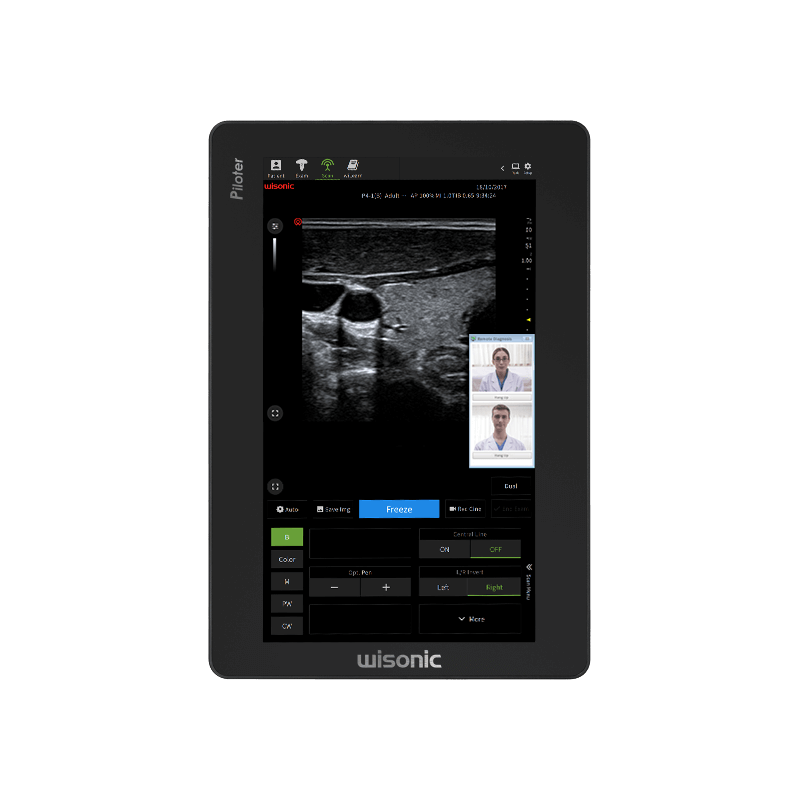Aparat USG Piloter Vet mobilny - Wisonic