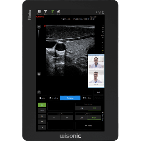 Aparat USG Piloter Vet mobilny - Wisonic